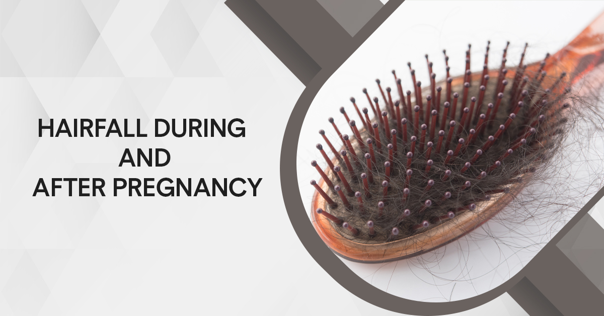 Hair fall During and After Pregnancy