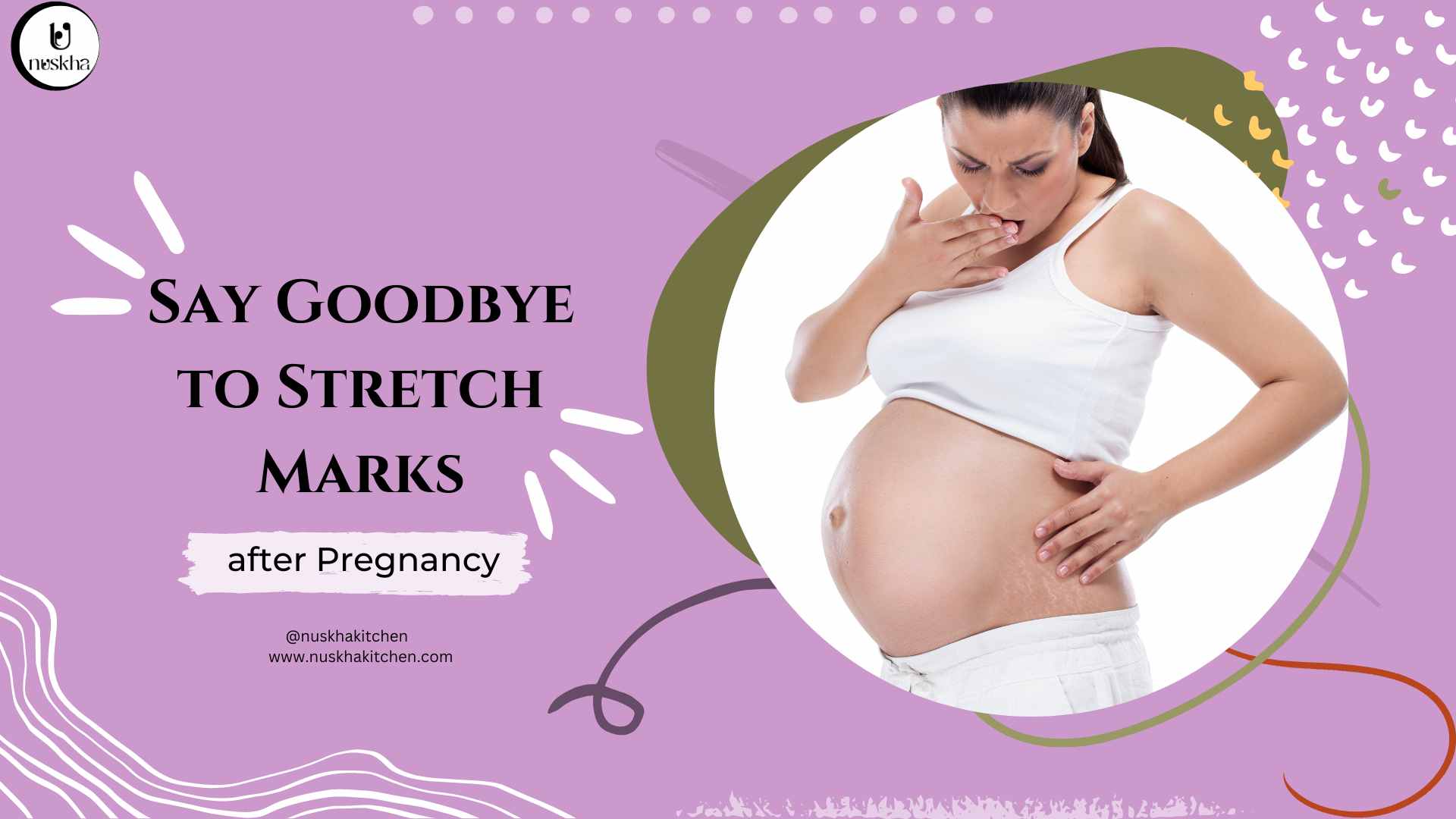 Say Goodbye to Stretch Marks after Pregnancy